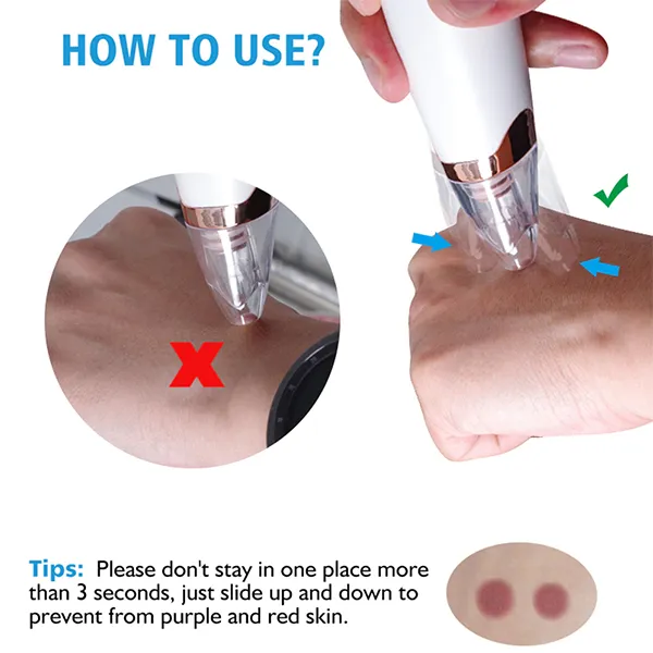Electric Vacuum Blackhead Remover Machine 6 Suction Head Beauty Machine For Skin Care image 5